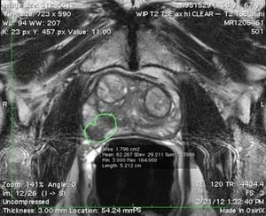 Advanced diagnosis with 3T-MRI-Imaging