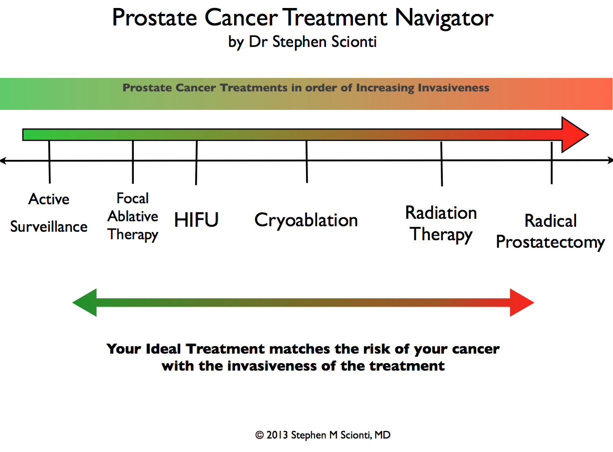 pca-navigator-risk-and-treatment pca-navigator-risk-and-treatment