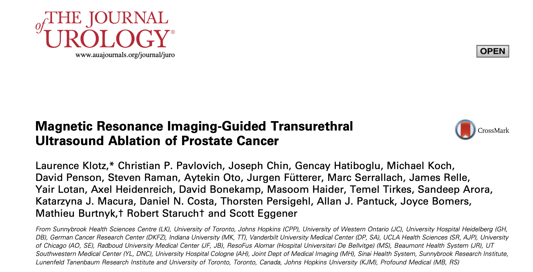 Journal of Urology article on TULSA Pro